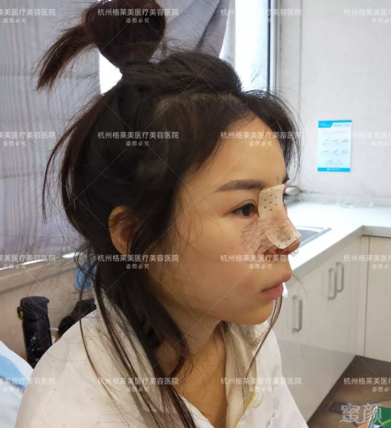 https://img.miyanlife.com/mnt/timg/190526/11294C234-10.jpg
