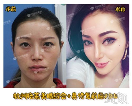https://img.miyanlife.com/mnt/timg/190526/112R61256-6.jpg