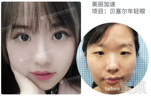 https://img.miyanlife.com/mnt/timg/190526/112R63257-4.jpg
