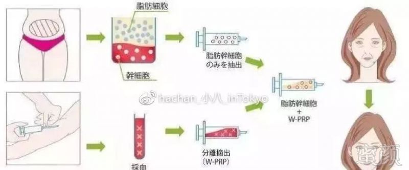 案例图片