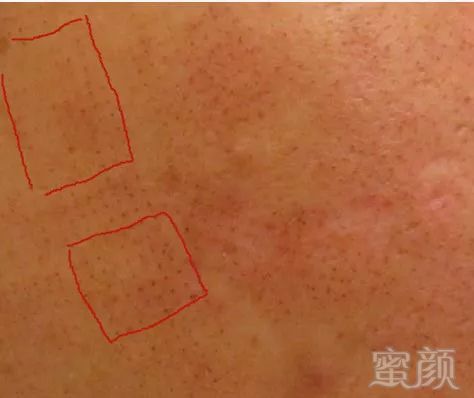 https://img.miyanlife.com/mnt/timg/190526/12064HK7-4.jpg