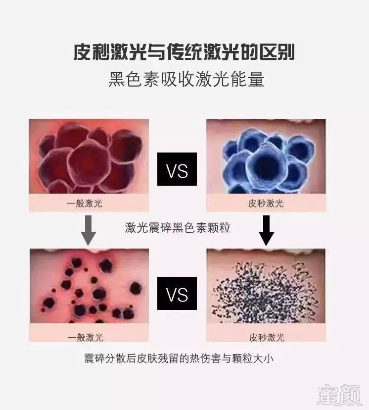 https://img.miyanlife.com/mnt/timg/190526/12064V107-6.jpg