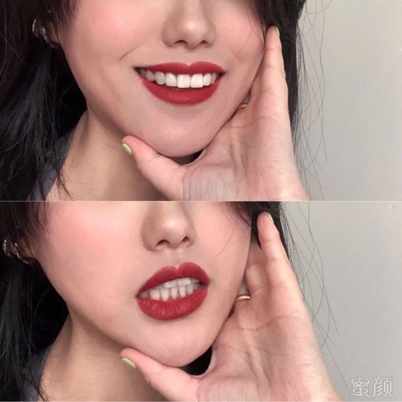 https://img.miyanlife.com/mnt/timg/190526/1212311150-7.jpg