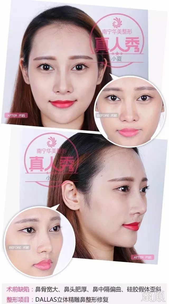 https://img.miyanlife.com/mnt/timg/190526/1212546019-4.jpg