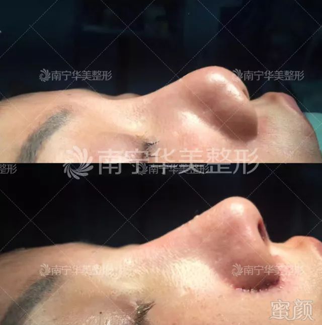 https://img.miyanlife.com/mnt/timg/190526/1212551132-5.jpg