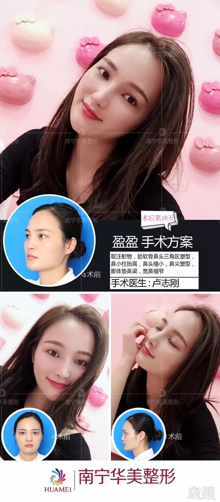 https://img.miyanlife.com/mnt/timg/190526/1212564144-7.jpg