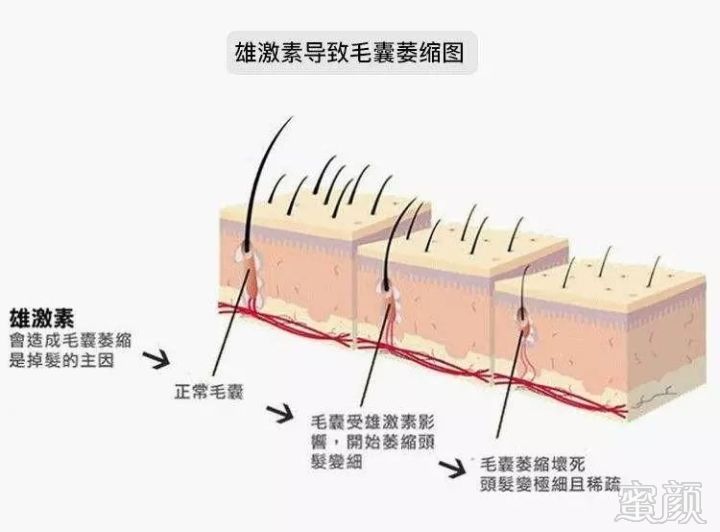 案例图片