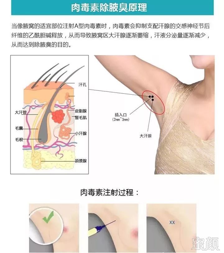 https://img.miyanlife.com/mnt/timg/190527/110I31132-9.jpg
