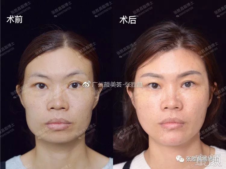 https://img.miyanlife.com/mnt/timg/190527/112203A27-4.jpg