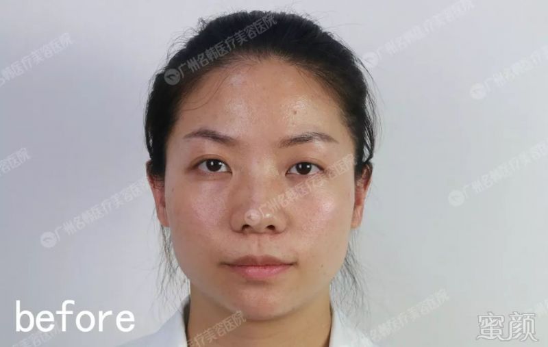https://img.miyanlife.com/mnt/timg/190527/113120G09-2.jpg