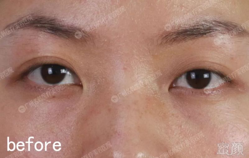https://img.miyanlife.com/mnt/timg/190527/1131211I1-3.jpg