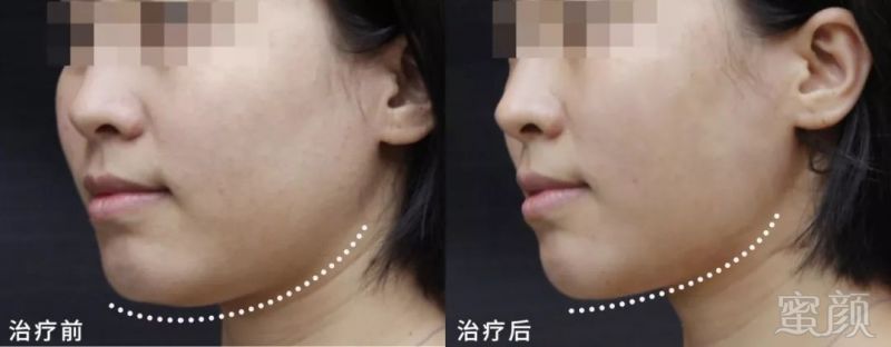 https://img.miyanlife.com/mnt/timg/190528/110534K10-0.jpg