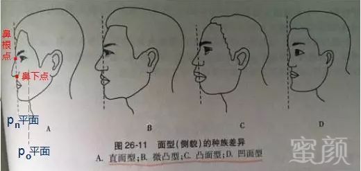 https://img.miyanlife.com/mnt/timg/190528/1130403O4-7.jpg