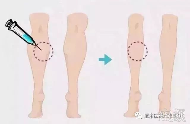https://img.miyanlife.com/mnt/timg/190528/1145396421-11.jpg
