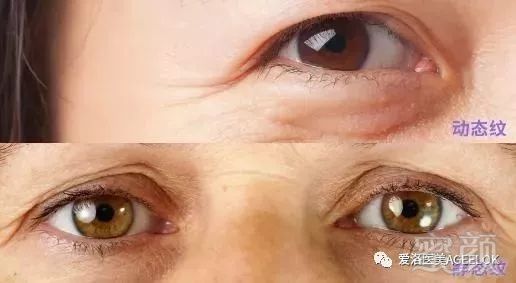 https://img.miyanlife.com/mnt/timg/190528/11453MD8-6.jpg