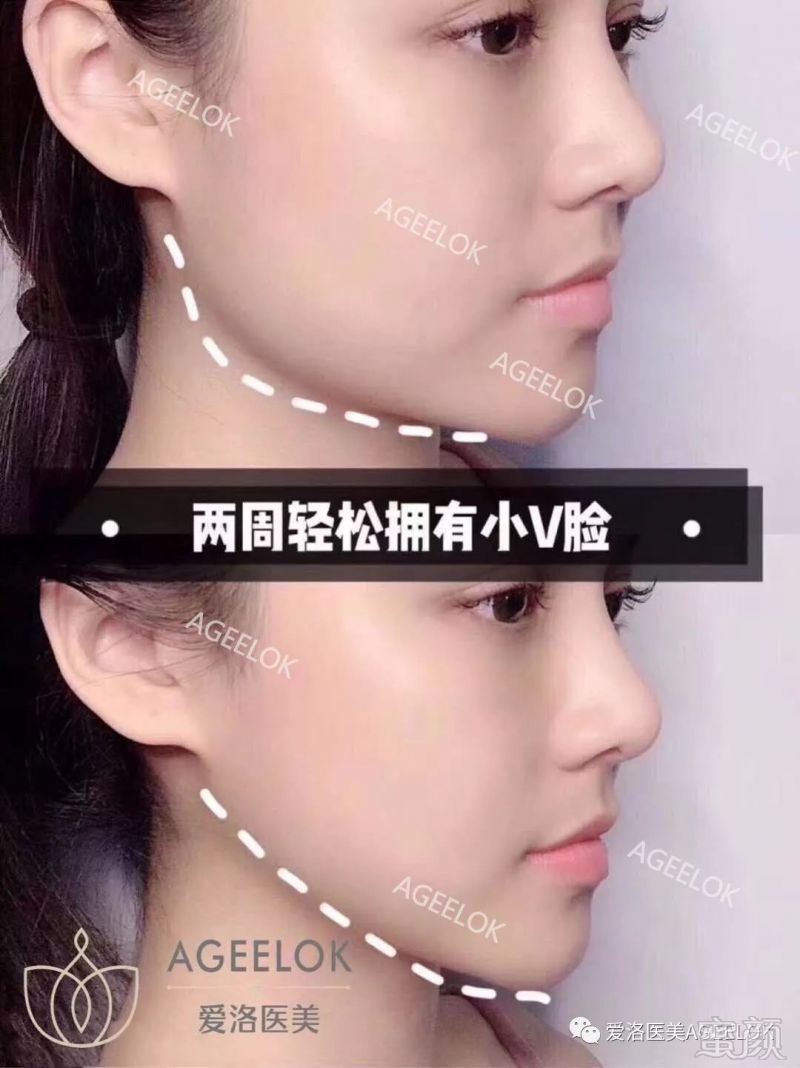 https://img.miyanlife.com/mnt/timg/190528/11453QV3-9.jpg