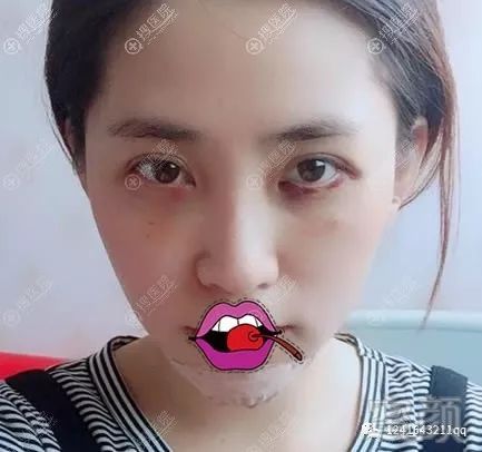 案例图片