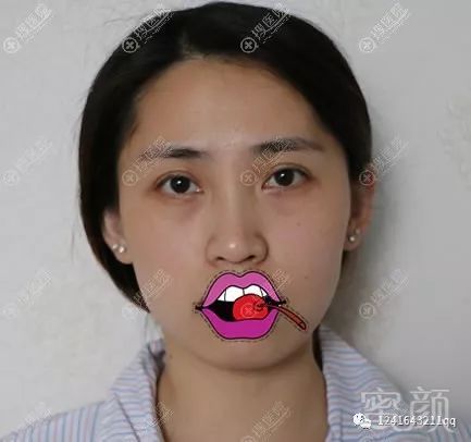 案例图片