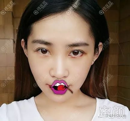 案例图片