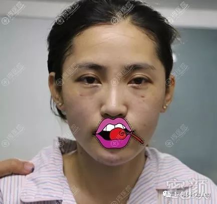 案例图片