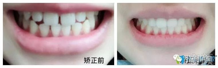 https://img.miyanlife.com/mnt/timg/190528/11541213I-0.jpg