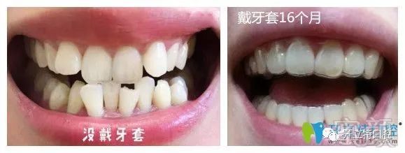 https://img.miyanlife.com/mnt/timg/190528/11541311I-2.jpg