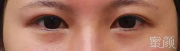 https://img.miyanlife.com/mnt/timg/190528/11594AC9-12.jpg