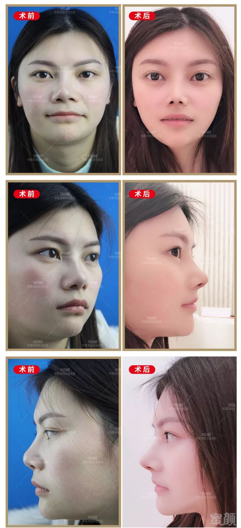 https://img.miyanlife.com/mnt/timg/190528/12020Ra6-0.jpg