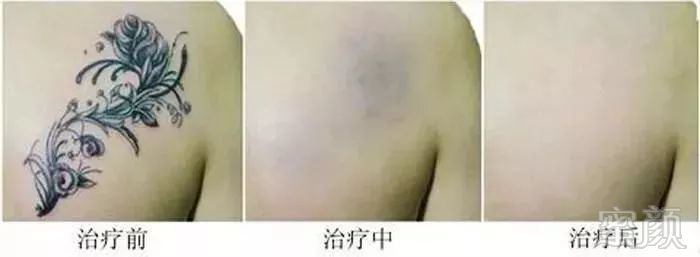 https://img.miyanlife.com/mnt/timg/190528/12062131P-6.jpg