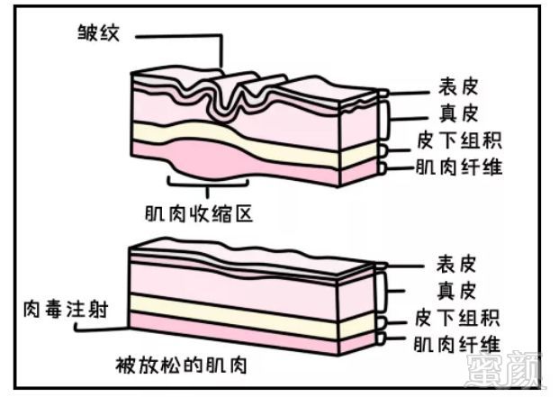 https://img.miyanlife.com/mnt/timg/190529/11513H146-15.jpg