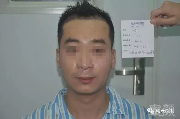 https://img.miyanlife.com/mnt/timg/190529/123A13N6-2.jpg 案例图片