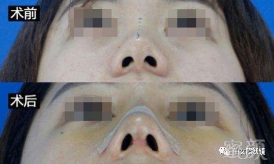 https://img.miyanlife.com/mnt/timg/190529/12432LV3-1.jpg