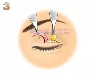 https://img.miyanlife.com/mnt/timg/190530/1134495592-11.jpg