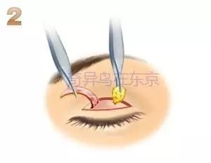 https://img.miyanlife.com/mnt/timg/190530/11344R262-5.jpg
