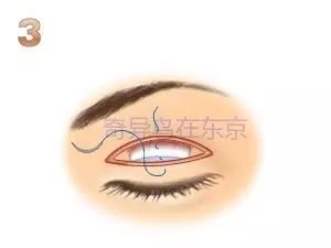 https://img.miyanlife.com/mnt/timg/190530/11344T949-6.jpg