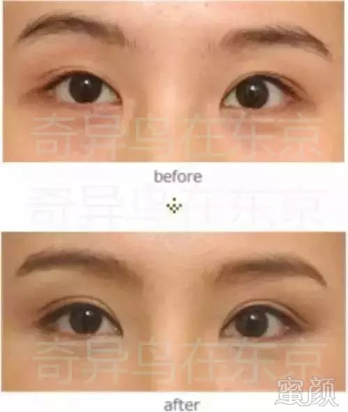 https://img.miyanlife.com/mnt/timg/190530/11344WZ0-8.jpg