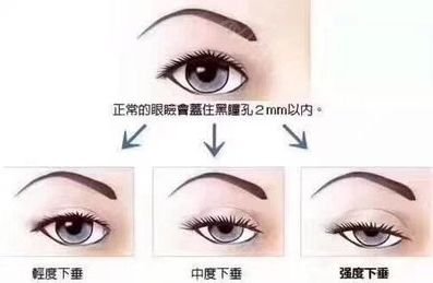 https://img.miyanlife.com/mnt/timg/190530/1135555Q8-1.jpg