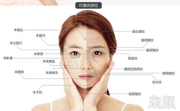 https://img.miyanlife.com/mnt/timg/190530/113F1B50-0.jpg
