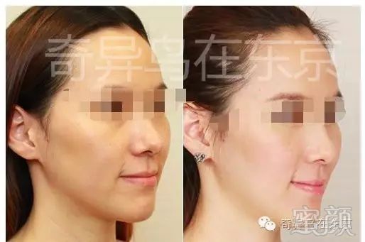 https://img.miyanlife.com/mnt/timg/190530/113F22450-3.jpg