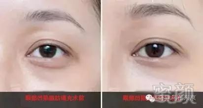 https://img.miyanlife.com/mnt/timg/190530/113F35505-7.jpg