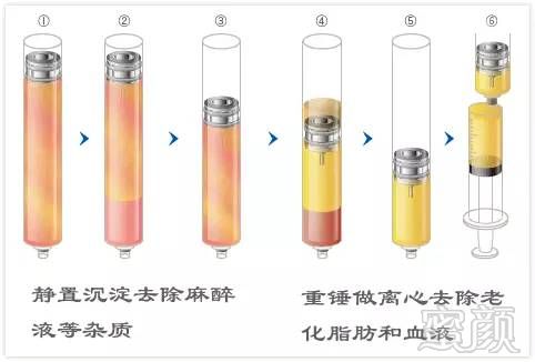 https://img.miyanlife.com/mnt/timg/190530/113F3N51-11.jpg