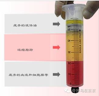 案例图片