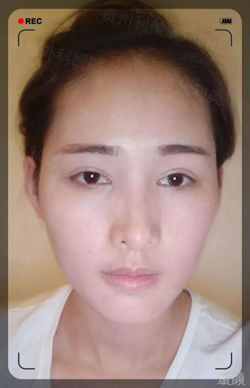 https://img.miyanlife.com/mnt/timg/190530/1141162Y3-8.jpg