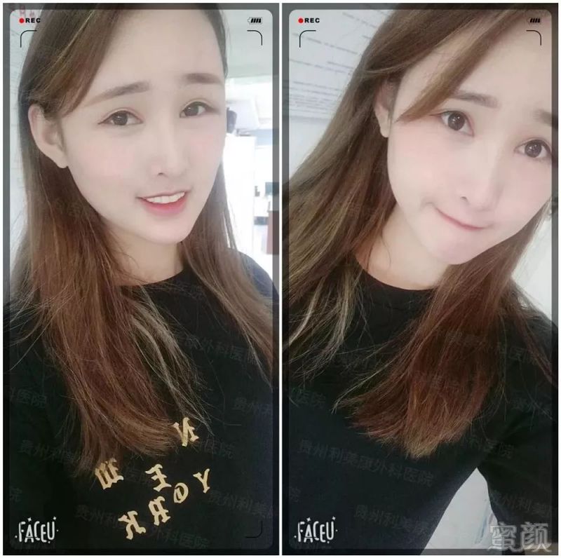 https://img.miyanlife.com/mnt/timg/190530/11412150K-13.jpg