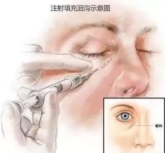 https://img.miyanlife.com/mnt/timg/190530/1220495515-12.jpg