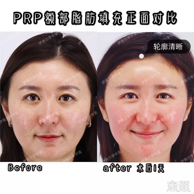 https://img.miyanlife.com/mnt/timg/190531/110Q45U5-0.jpg