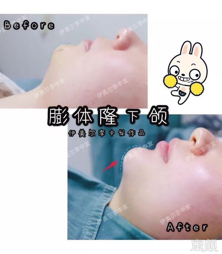 https://img.miyanlife.com/mnt/timg/190531/110Q52023-2.jpg