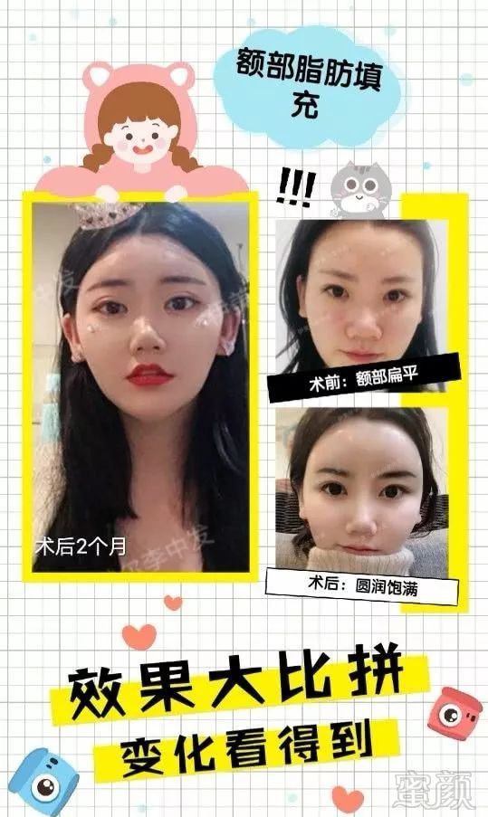 https://img.miyanlife.com/mnt/timg/190531/110Q625E-3.jpg