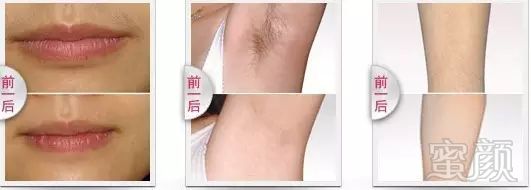 https://img.miyanlife.com/mnt/timg/190531/112U1EQ-3.jpg