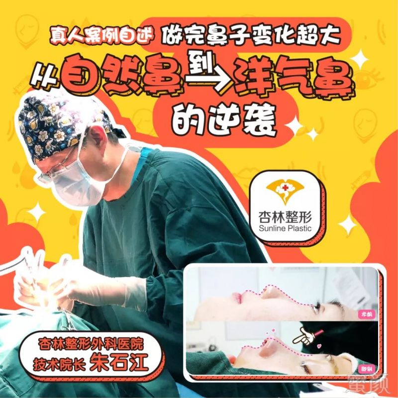https://img.miyanlife.com/mnt/timg/190531/1146492M4-0.jpg